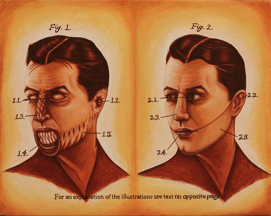 Prosthetic Solutions to Demonic Possession