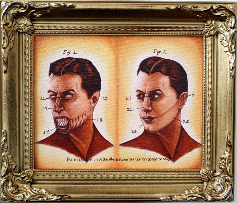 Prosthetic Solutions to Demonic Possession