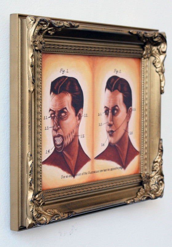 Prosthetic Solutions to Demonic Possession